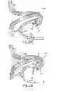 Fig. 15 - APPARATUS AND METHODS FOR FORMING AND SECURING GASTROINTESTINAL TISSUE FOLDS