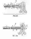 Fig. 16 - APPARATUS AND METHODS FOR FORMING AND SECURING GASTROINTESTINAL TISSUE FOLDS