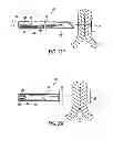 Fig. 18 - APPARATUS AND METHODS FOR FORMING AND SECURING GASTROINTESTINAL TISSUE FOLDS