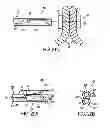 Fig. 19 - APPARATUS AND METHODS FOR FORMING AND SECURING GASTROINTESTINAL TISSUE FOLDS