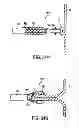 Fig. 28 - APPARATUS AND METHODS FOR FORMING AND SECURING GASTROINTESTINAL TISSUE FOLDS