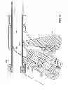 Fig. 31 - APPARATUS AND METHODS FOR FORMING AND SECURING GASTROINTESTINAL TISSUE FOLDS
