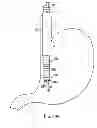 Fig. 33 - APPARATUS AND METHODS FOR FORMING AND SECURING GASTROINTESTINAL TISSUE FOLDS