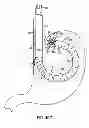 Fig. 35 - APPARATUS AND METHODS FOR FORMING AND SECURING GASTROINTESTINAL TISSUE FOLDS