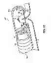 Fig. 43 - APPARATUS AND METHODS FOR FORMING AND SECURING GASTROINTESTINAL TISSUE FOLDS