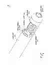 Fig. 02 - CATHETER SYSTEM FOR VASCULAR RE-ENTRY FROM A SUB-INTIMAL SPACE
