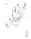 Fig. 04 - CATHETER SYSTEM FOR VASCULAR RE-ENTRY FROM A SUB-INTIMAL SPACE