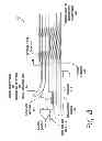 Fig. 05 - CATHETER SYSTEM FOR VASCULAR RE-ENTRY FROM A SUB-INTIMAL SPACE