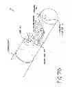 Fig. 09 - CATHETER SYSTEM FOR VASCULAR RE-ENTRY FROM A SUB-INTIMAL SPACE