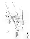 Fig. 10 - CATHETER SYSTEM FOR VASCULAR RE-ENTRY FROM A SUB-INTIMAL SPACE