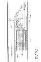 Fig. 13 - CATHETER SYSTEM FOR VASCULAR RE-ENTRY FROM A SUB-INTIMAL SPACE