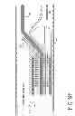 Fig. 16 - CATHETER SYSTEM FOR VASCULAR RE-ENTRY FROM A SUB-INTIMAL SPACE