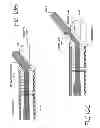 Fig. 18 - CATHETER SYSTEM FOR VASCULAR RE-ENTRY FROM A SUB-INTIMAL SPACE