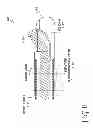 Fig. 20 - CATHETER SYSTEM FOR VASCULAR RE-ENTRY FROM A SUB-INTIMAL SPACE