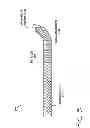 Fig. 23 - CATHETER SYSTEM FOR VASCULAR RE-ENTRY FROM A SUB-INTIMAL SPACE