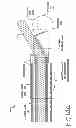 Fig. 24 - CATHETER SYSTEM FOR VASCULAR RE-ENTRY FROM A SUB-INTIMAL SPACE