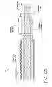 Fig. 25 - CATHETER SYSTEM FOR VASCULAR RE-ENTRY FROM A SUB-INTIMAL SPACE