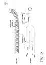 Fig. 26 - CATHETER SYSTEM FOR VASCULAR RE-ENTRY FROM A SUB-INTIMAL SPACE