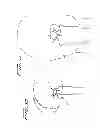 Fig. 07 - Rotational thrombectomy wire