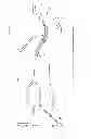 Fig. 10 - Rotational thrombectomy wire