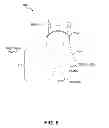 Fig. 11 - Methods for treating skin laxity