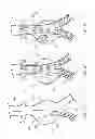 Fig. 07 - Bodily Lumen Closure Apparatus and Method