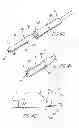 Fig. 15 - Bodily Lumen Closure Apparatus and Method