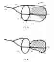Fig. 09 - Complex wire formed devices