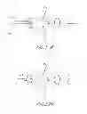 Fig. 09 - Method of implanting an adjustable occlusion device