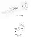 Fig. 12 - Method of implanting an adjustable occlusion device