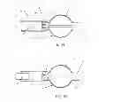 Fig. 07 - Embolic implant and method of use