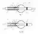Fig. 08 - Embolic implant and method of use