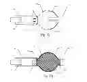 Fig. 09 - Embolic implant and method of use