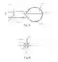 Fig. 10 - Embolic implant and method of use