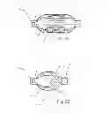 Fig. 13 - Embolic implant and method of use