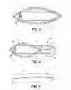 Fig. 03 - Device and method to facilitate safe, adhesion-free surgical closures