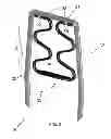 Fig. 04 - Adjustable Compression Staple and Method for Stapling With Adjustable Compression