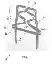 Fig. 06 - Adjustable Compression Staple and Method for Stapling With Adjustable Compression