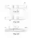 Fig. 08 - Multi-durometer reinforced suture sleeve