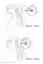 Fig. 03 - Method and apparatus for improving cervical curvature and for maintaining proper curvature in persons predisposed to develop improper curvature