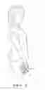 Fig. 05 - Method and apparatus for improving cervical curvature and for maintaining proper curvature in persons predisposed to develop improper curvature