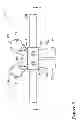 Fig. 10 - VERTEBRAL FIXATION SYSTEM