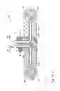 Fig. 15 - VERTEBRAL FIXATION SYSTEM