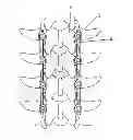 Fig. 01 - Spinal osteosynthesis device and preparation method
