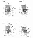 Fig. 03 - Spinal osteosynthesis device and preparation method