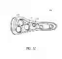 Fig. 03 - Hip fracture device with static locking mechanism allowing compression