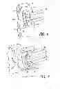 Fig. 06 - Hip fracture device with static locking mechanism allowing compression