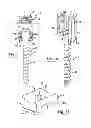 Fig. 06 - Uniplanar bone anchor system