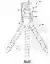 Fig. 18 - Uniplanar bone anchor system