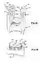 Fig. 20 - Uniplanar bone anchor system